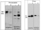 Anti-VEGFR-2 Antibody